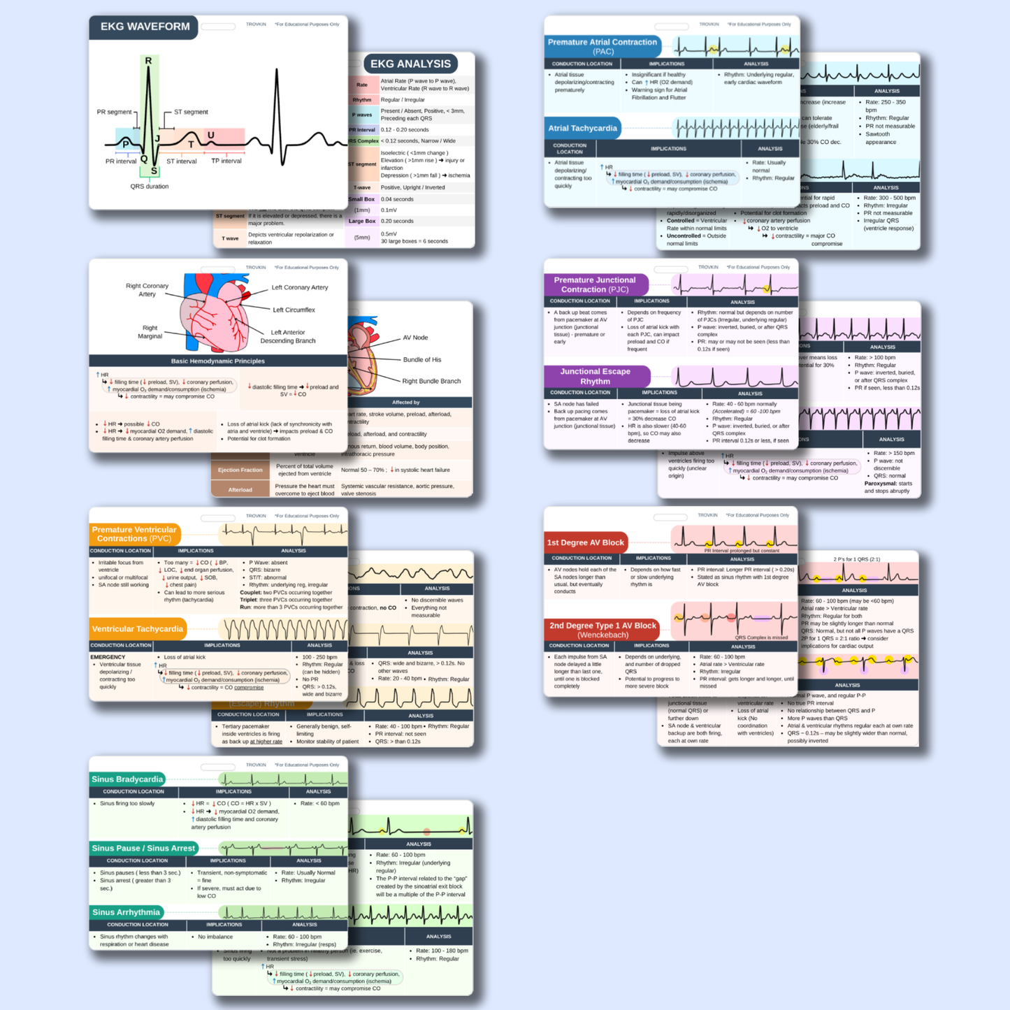 EKG Pocket Badge Cards - EKG Rhythm Interpretation Reference Guide