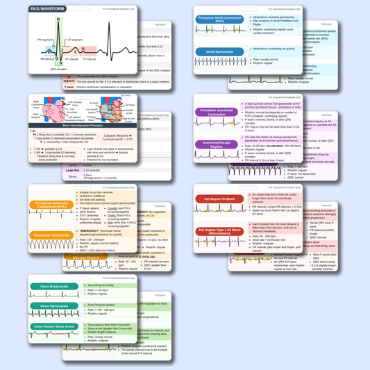 EKG Pocket Badge Cards - EKG Rhythm Interpretation Reference Guide